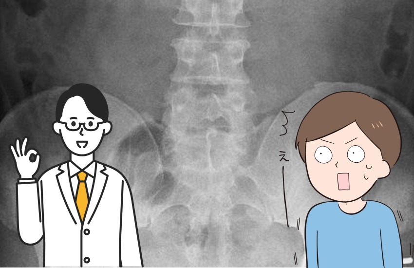 腰痛　異常なし　治らない